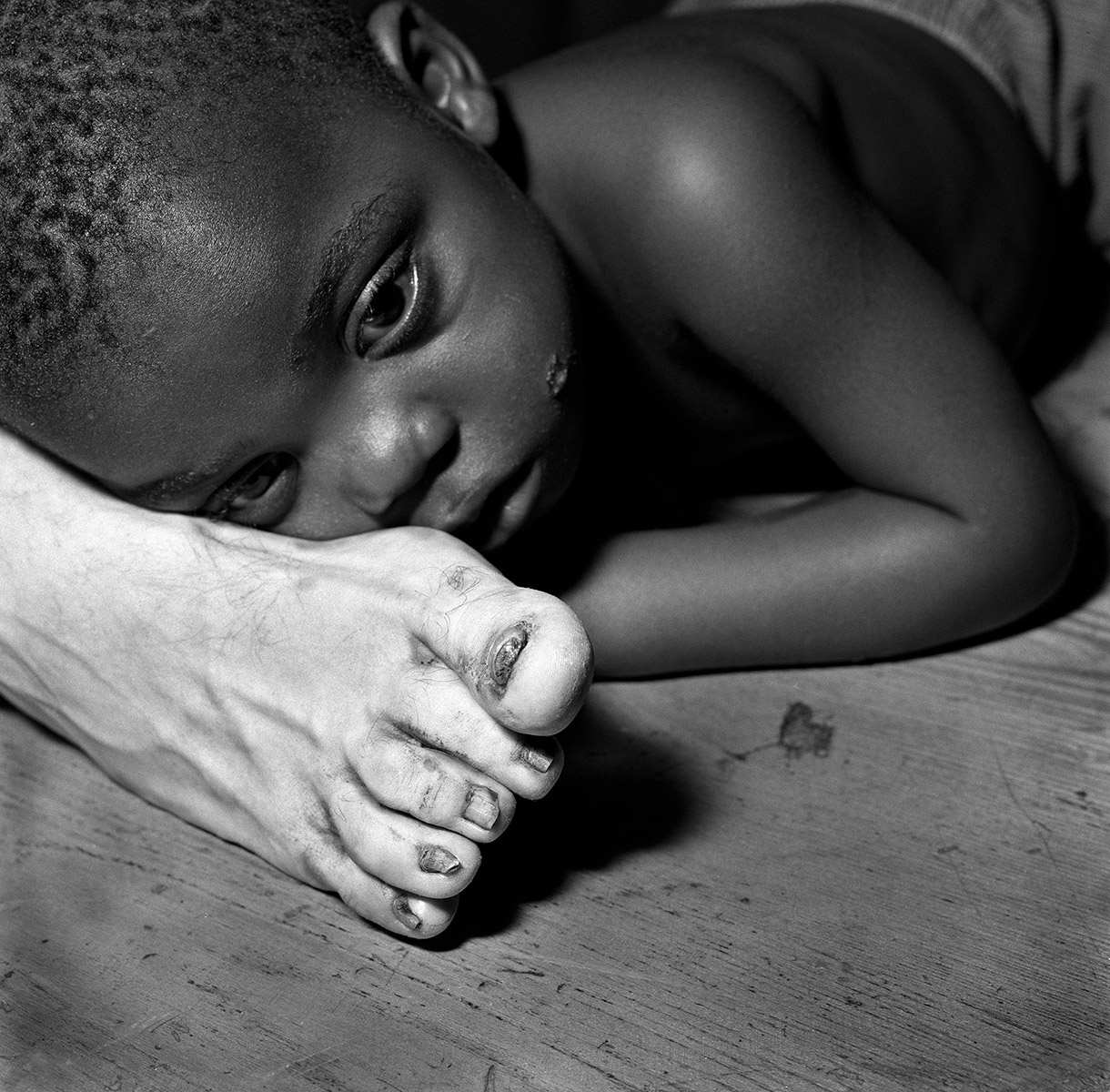 Black-child-on-white-foot-1999